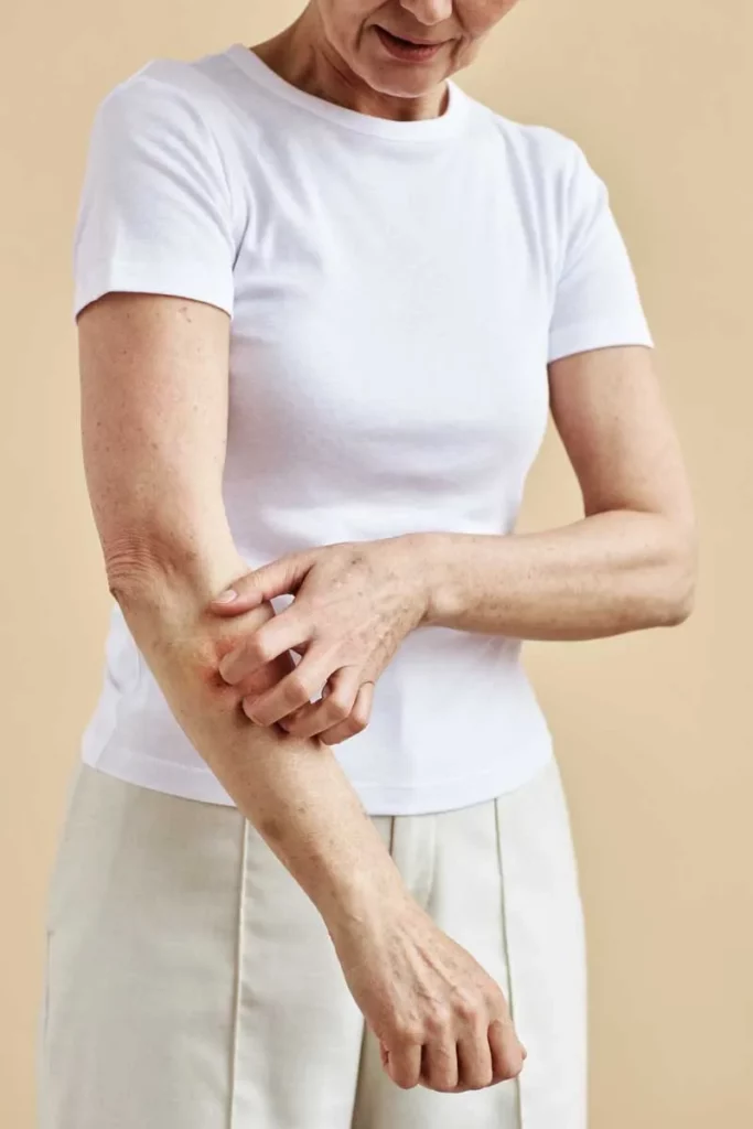 Arthritic Pain